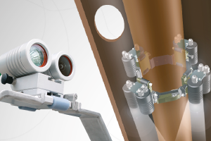 I-Tube Video Inspection System